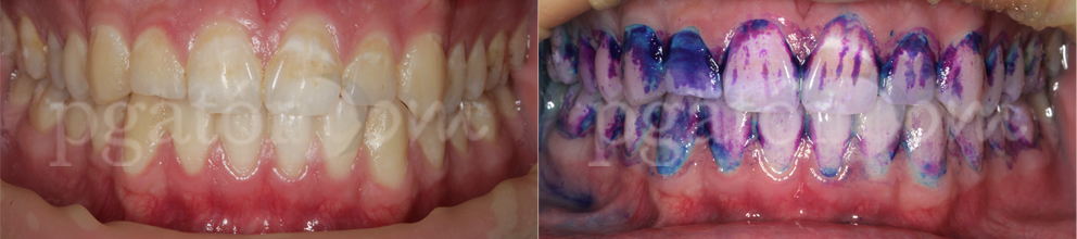 OMI para Auxiliar Clínica Dental